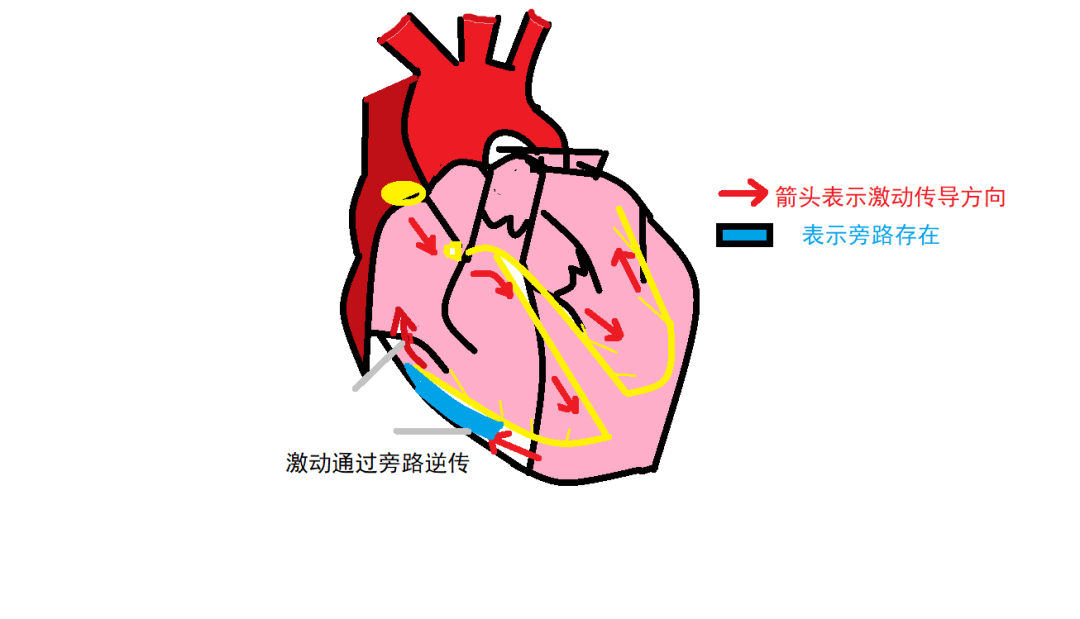 引起心跳突然加快的是“它”