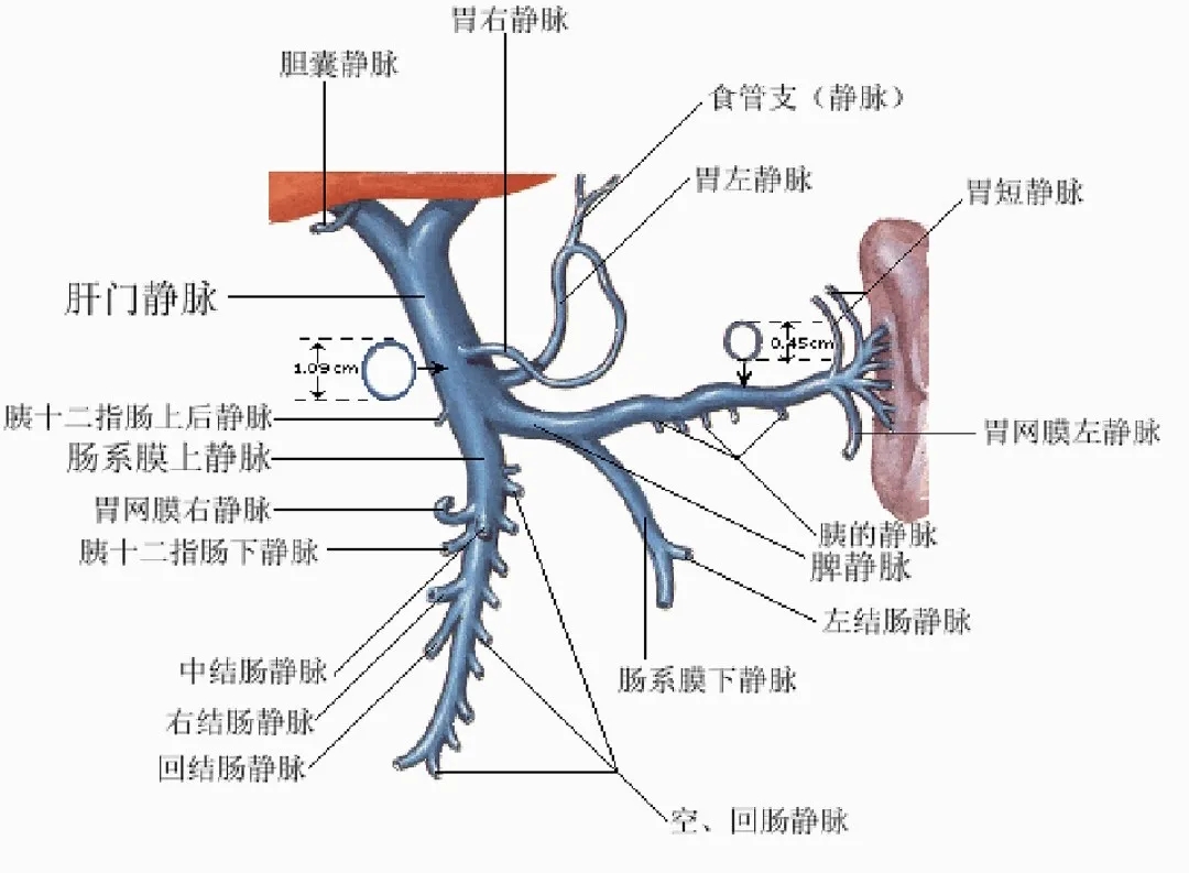 反復(fù)嘔血、黑便怎么辦？TIPS手術(shù)能解決