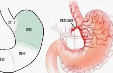 不開(kāi)刀不吃藥不餓肚子，微創(chuàng)介入減肥靠譜嗎？